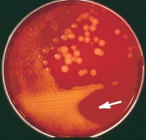 Streptococcus Pyogenes (GAS): Characteristics, .